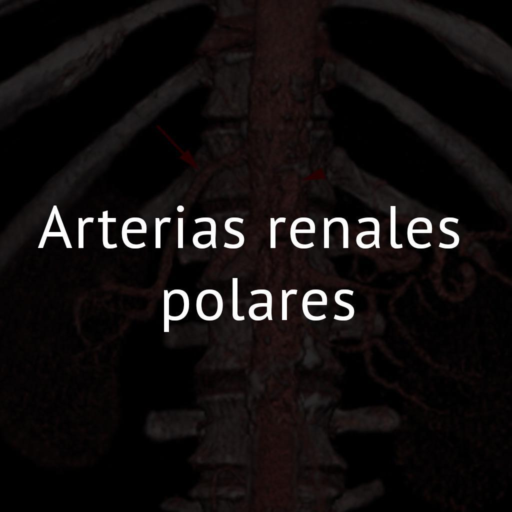 Arterias renales polares