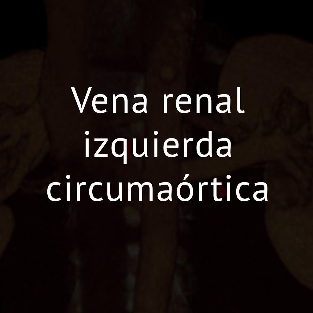 Vena renal izquierda circumaórtica
