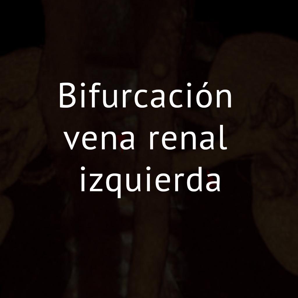 Bifurcación vena renal izquierda