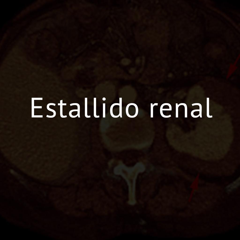 Estallido renal