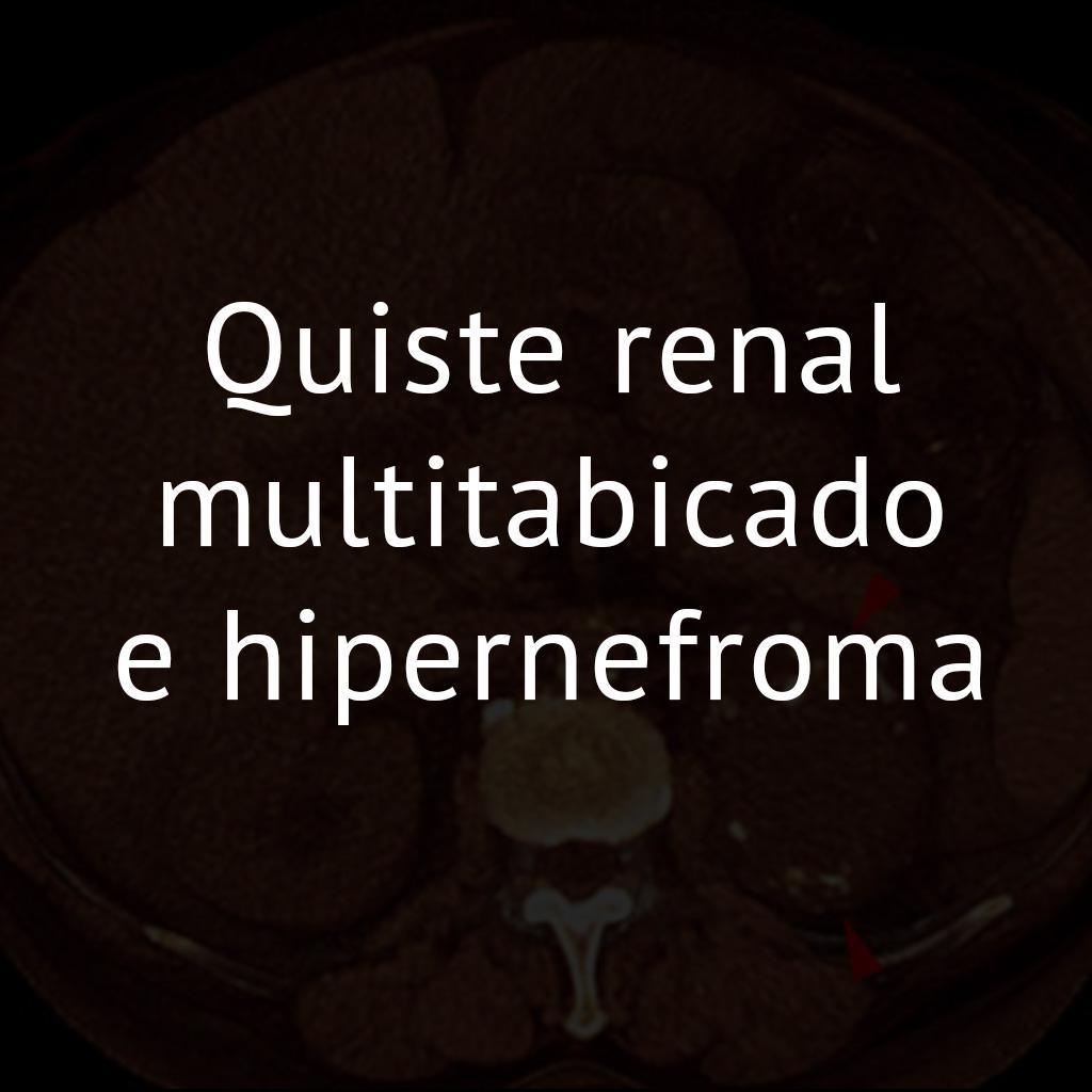 Quiste renal multitabicado e hipernefroma