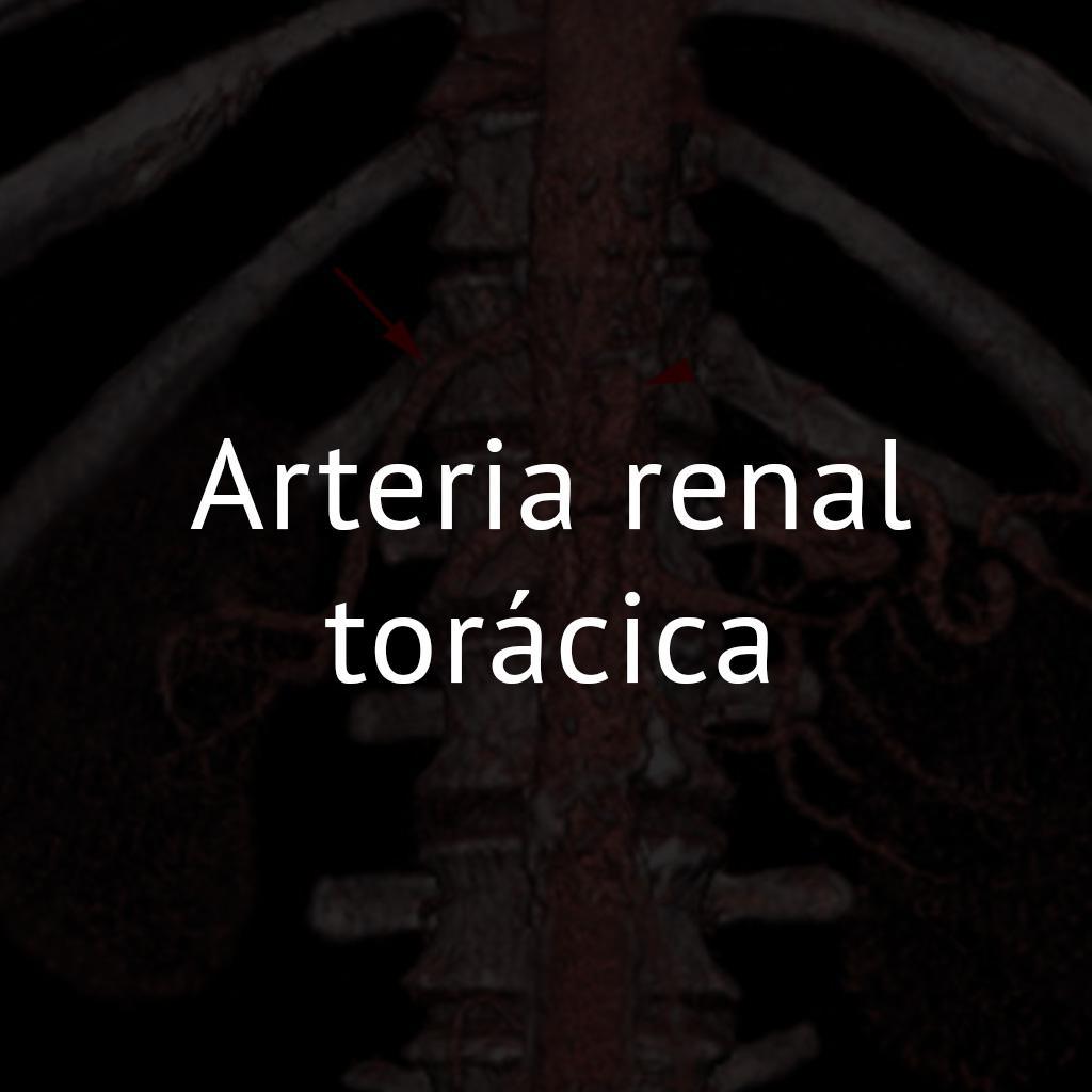 Arteria renal torácica