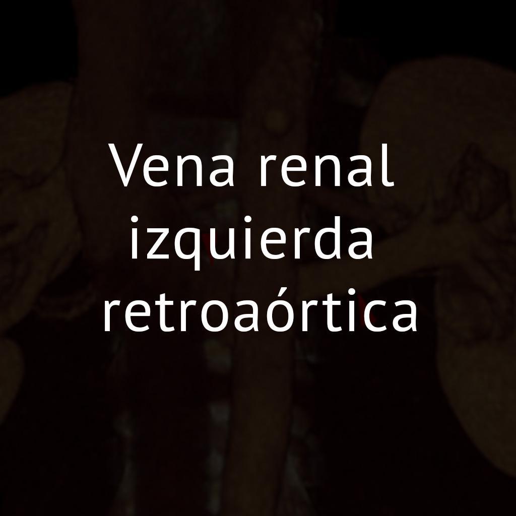 Vena renal izquierda retroaórtica