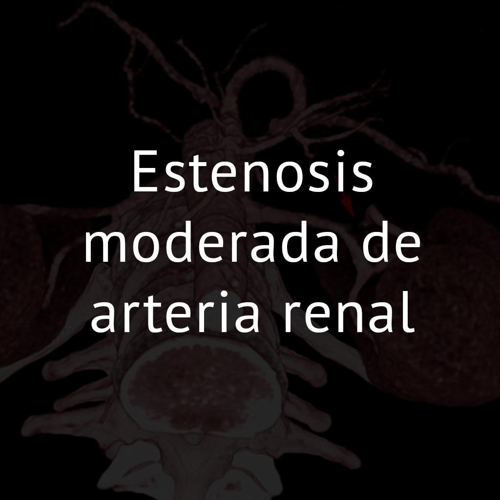 Estenosis moderada de arteria renal