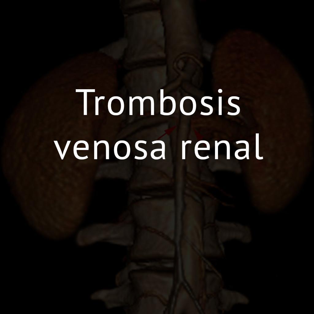 Trombosis venosa renal