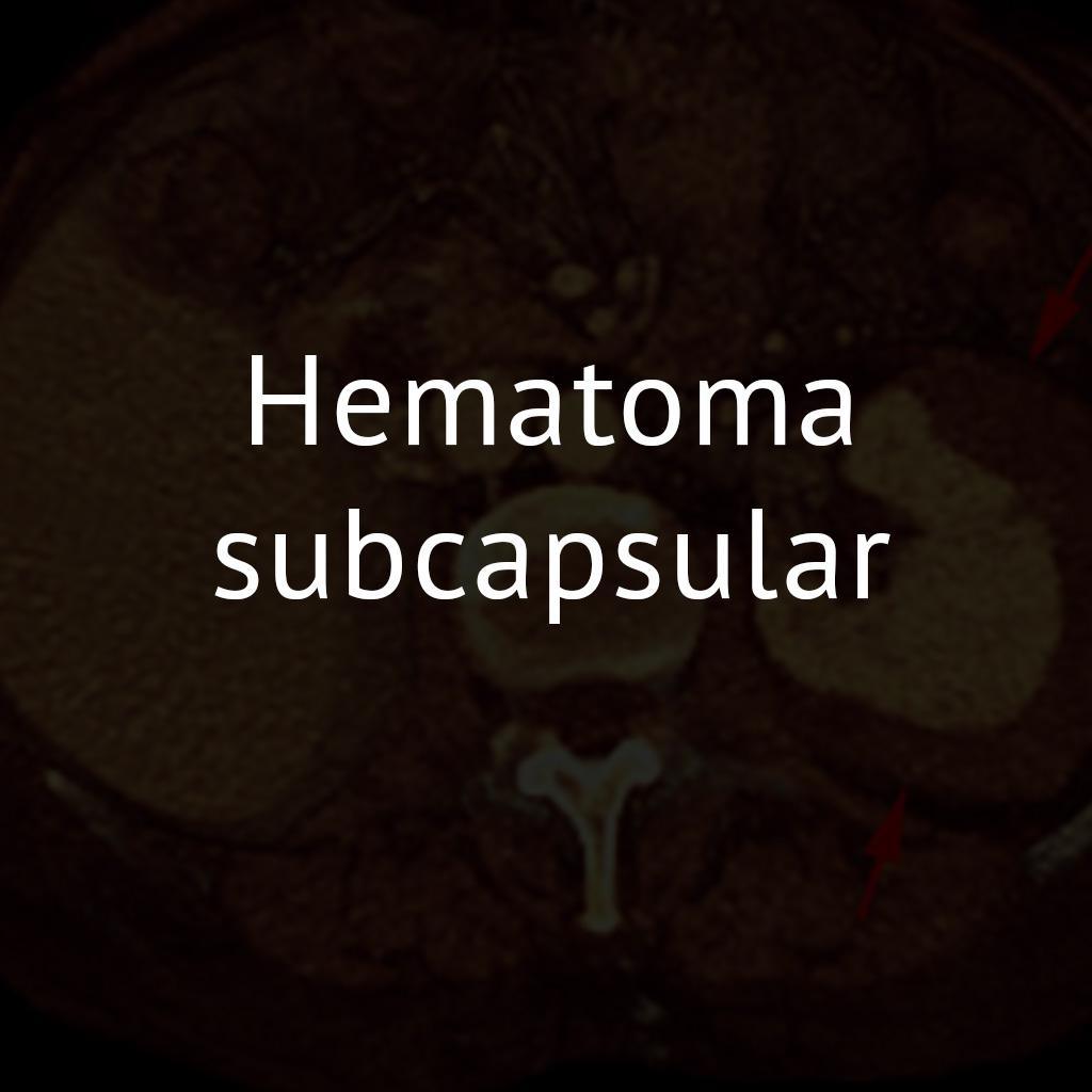 Hematoma subcapsular