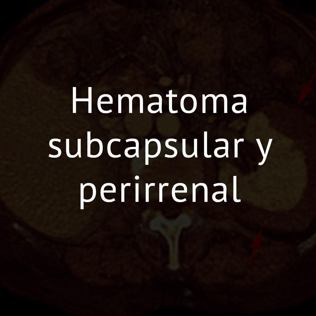 Hematoma subcapsular y perirrenal