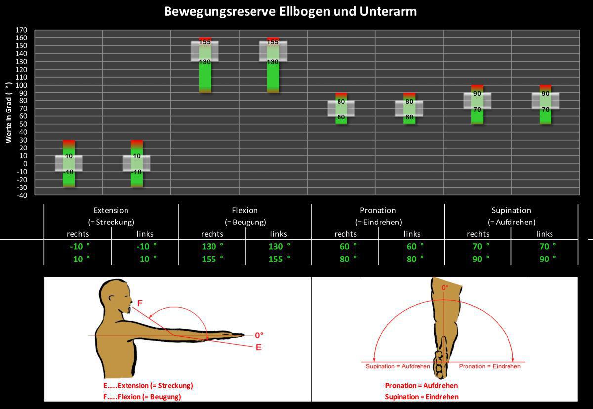 X-CARD 14: Sind Ihr Ellbogen und Ihre Hand fit ? X-CARD 14: Sind Ihr Ellbogen und Ihre Hand fit ?