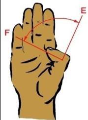 X-CARD 14: Sind Ihr Ellbogen und Ihre Hand fit ?