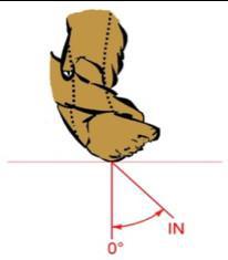 X-CARD 17: Sind Ihr Sprunggelenk und Ihr Fuß fit ?