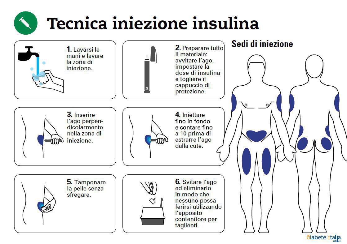 Retinopatia diabetica