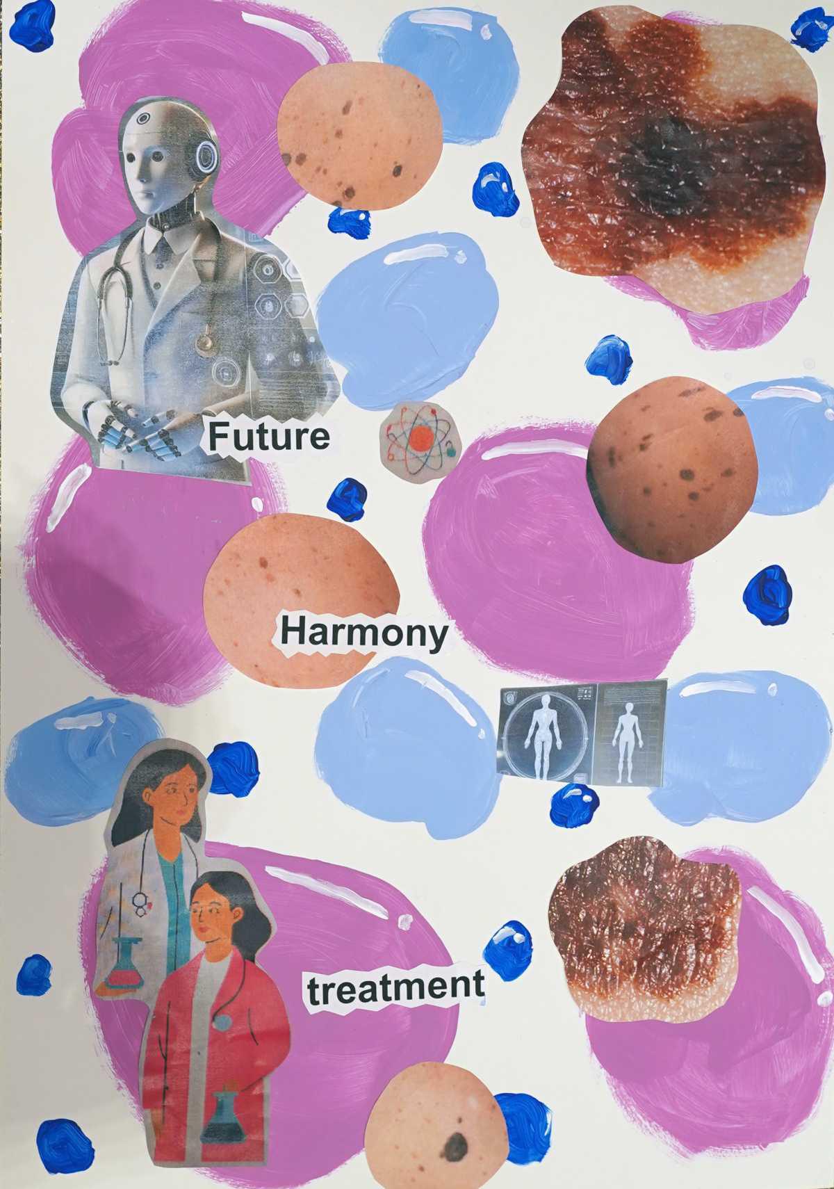 Artificial Intelligence in the Detection and Diagnosis of Superficial Extensive Melanomas Artificial Intelligence in the Detection and Diagnosis of Superficial Extensive Melanomas