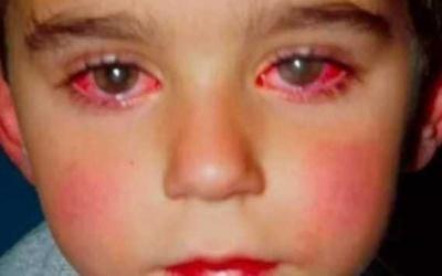 Cet enfant a perdu 75% de sa vue à cause d’un jouet que vous avez certainement à la maison