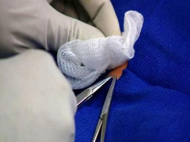 Un bébé nigérian de 2 ans meurt en Italie à la suite d'une circoncision