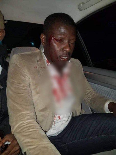 La caravane de "Sonko Président" attaquée à Saint-Louis, 4 blessés dont un dans un état grave
