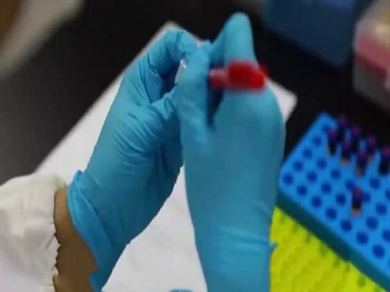 Yeumbeul Nord: un individu testé positif activement recherché