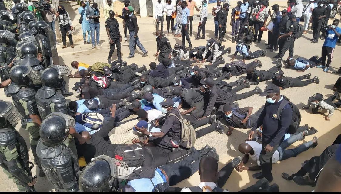 Répression des manifestations des Asp: l’un d’entre eux perd tous ses doigts à Ziguinchor