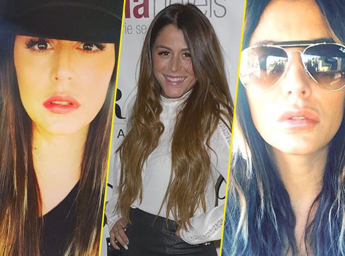 Anaïs Camizuli : "À cause des internautes, j'ai fait refaire mes lèvres !