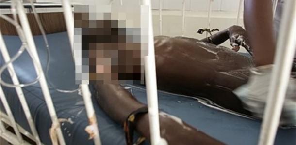 Kaolack : Un prisonnier se coupe les parties intimes