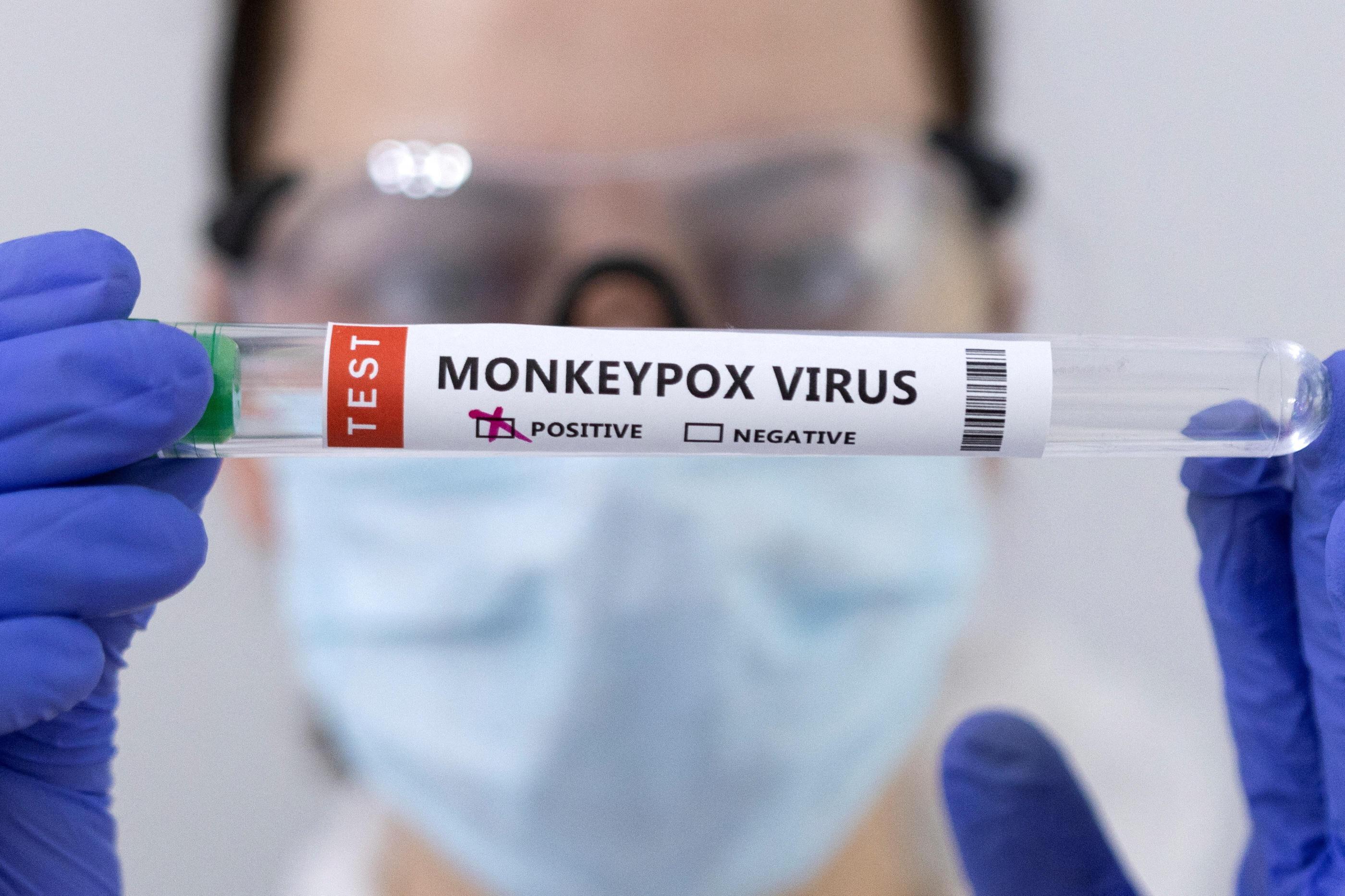 Nouveau variant de Mpox : l'OMS redoute une transmission internationale depuis la RDC