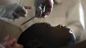 RDC : un nouveau massacre à Beni