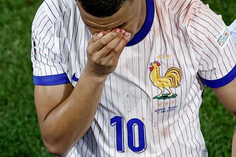 Euro-2024 : le Portugal de Ronaldo dernier à entrer en lice, le nez de Mbappé inquiète