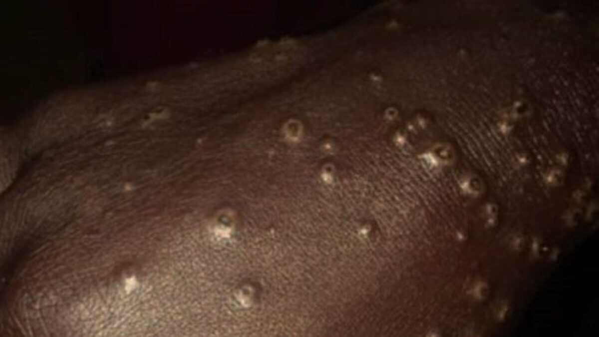 Mystérieuse maladie des pêcheurs de la Petite Côte : une microalgue toxique comme coupable après cinq ans d'incertitude