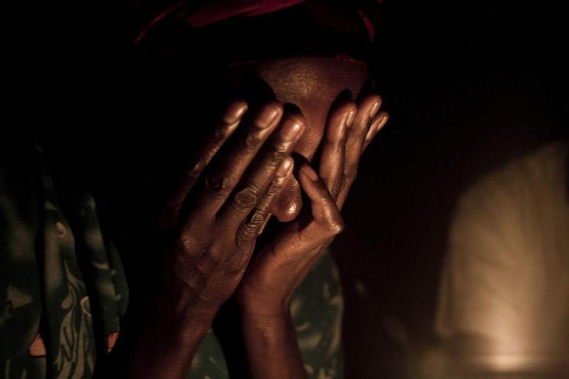 Mbacké : une femme grièvement brûlée à l'acide par la sœur cadette de son mari 