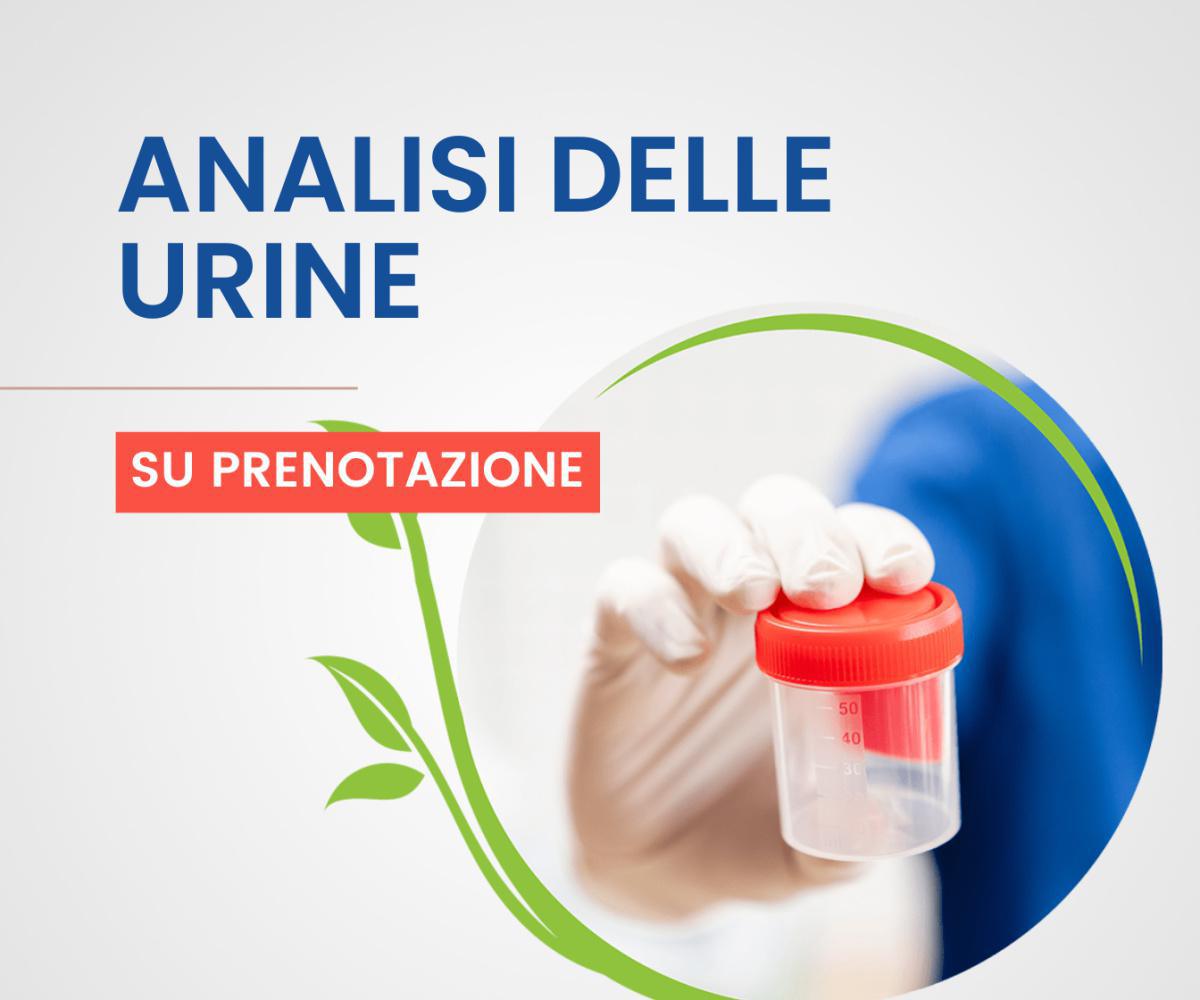 Analisi delle urine