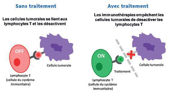 Les différents types d’immunothérapies Les différents types d’immunothérapies