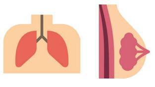 Les traitements actuels du cancer Les traitements actuels du cancer