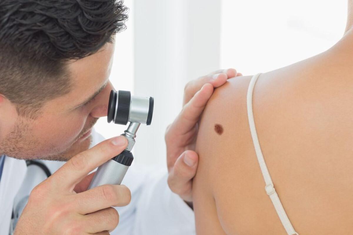Servizio di Teledermatologia Servizio di Teledermatologia