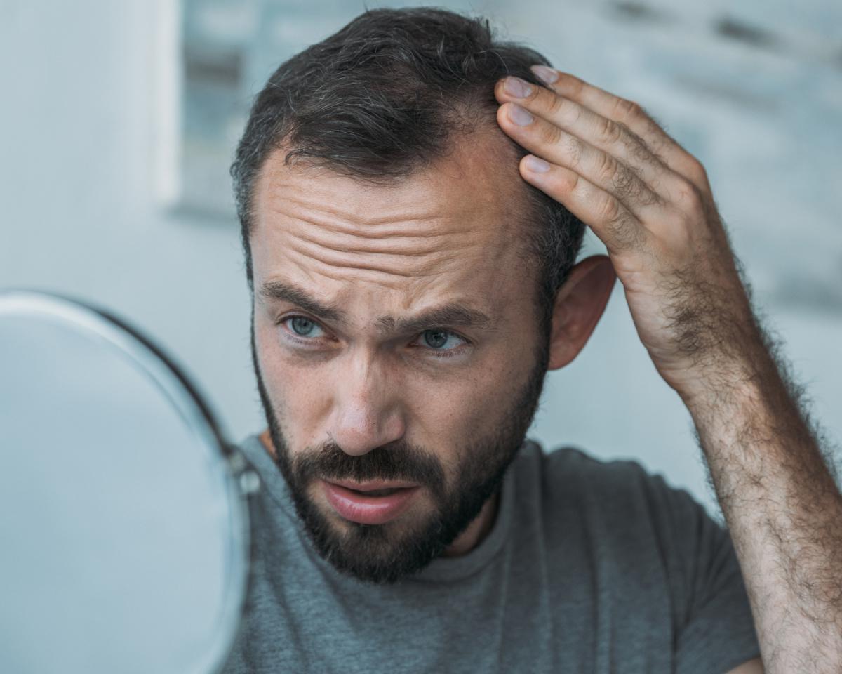 Perdita dei capelli: cos'è e quali sono le cause