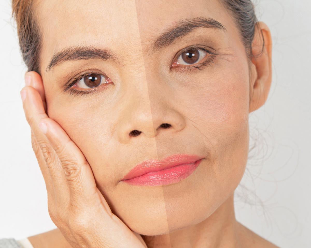 L'Alimentazione per una Pelle Sana L'Alimentazione per una Pelle Sana