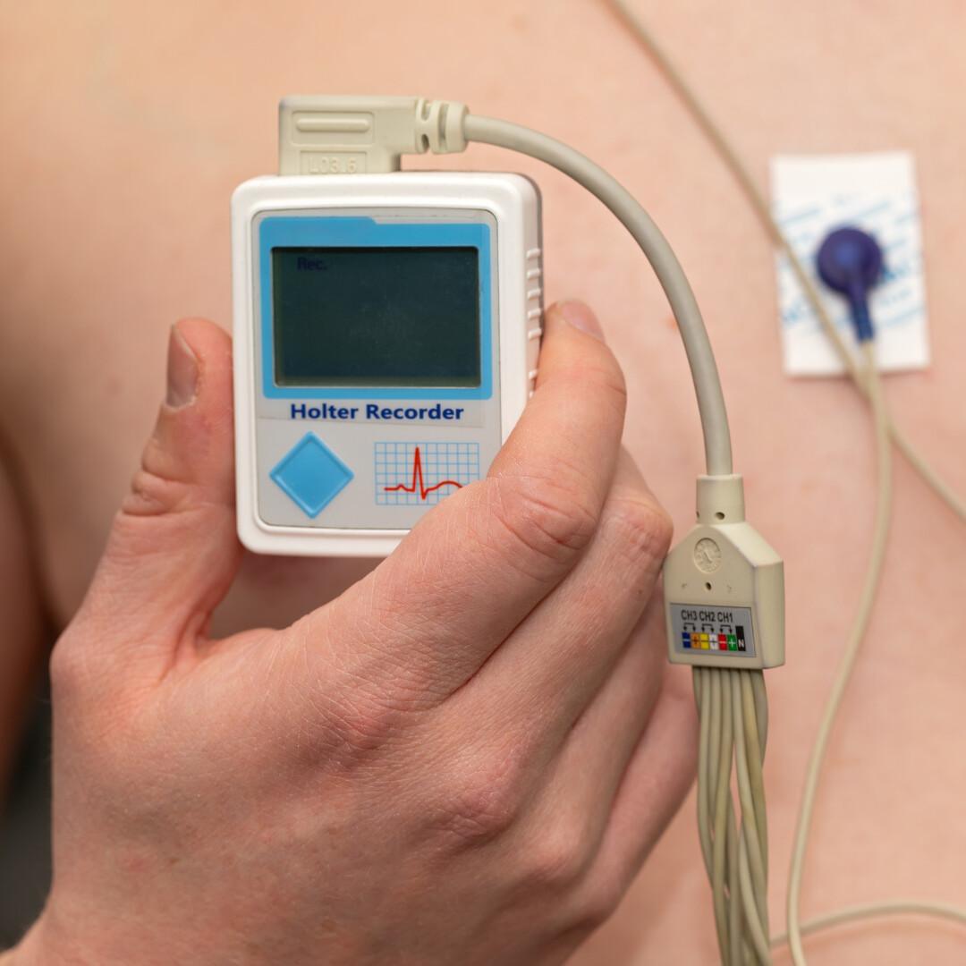Holter Cardiaco Holter Cardiaco