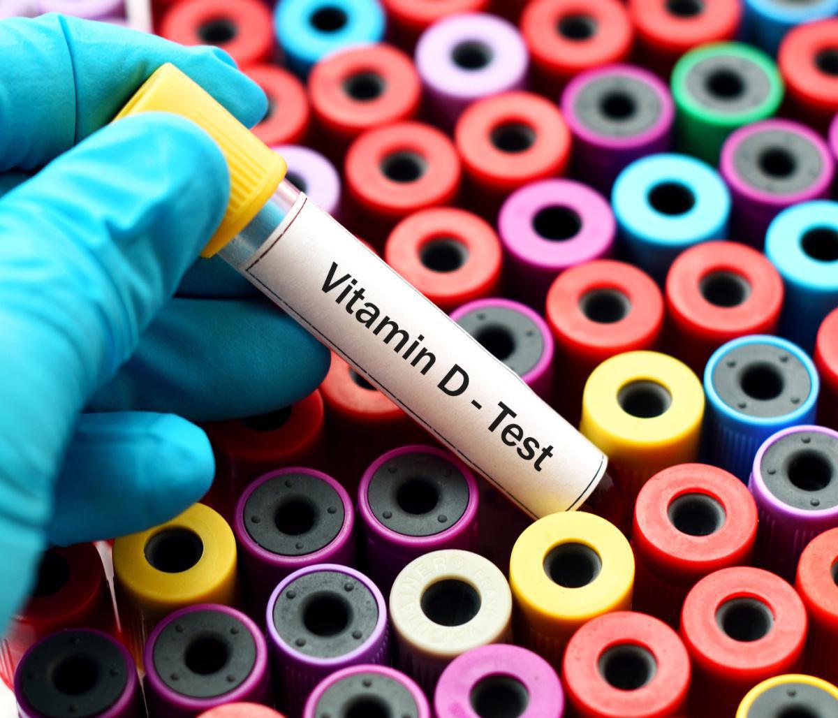Test Vitamina D Test Vitamina D