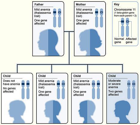 Beta-Thalassemia