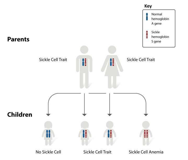 Sickle Cell Disease