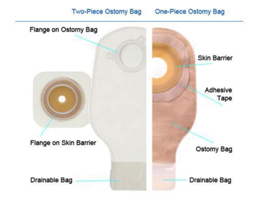 What to Expect After Surgery What to Expect After Surgery