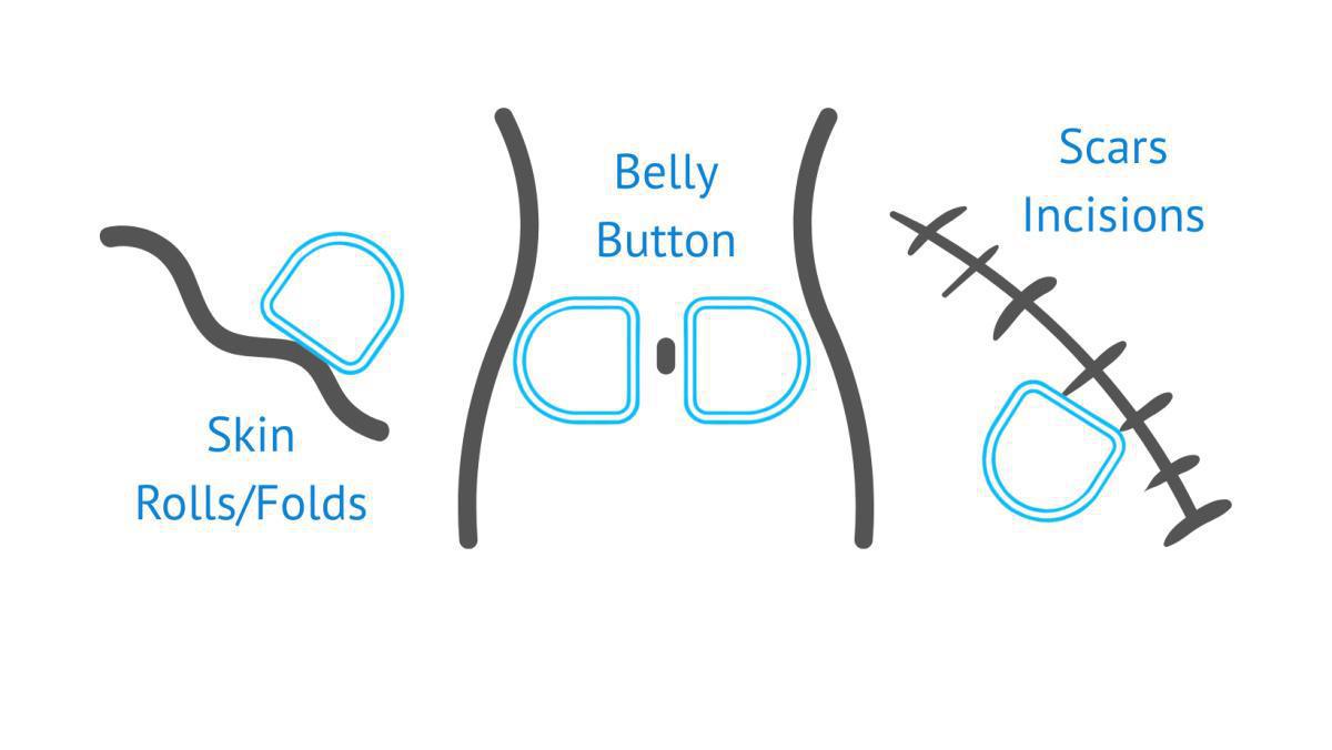 The Pouching System You Personalize The Pouching System You Personalize