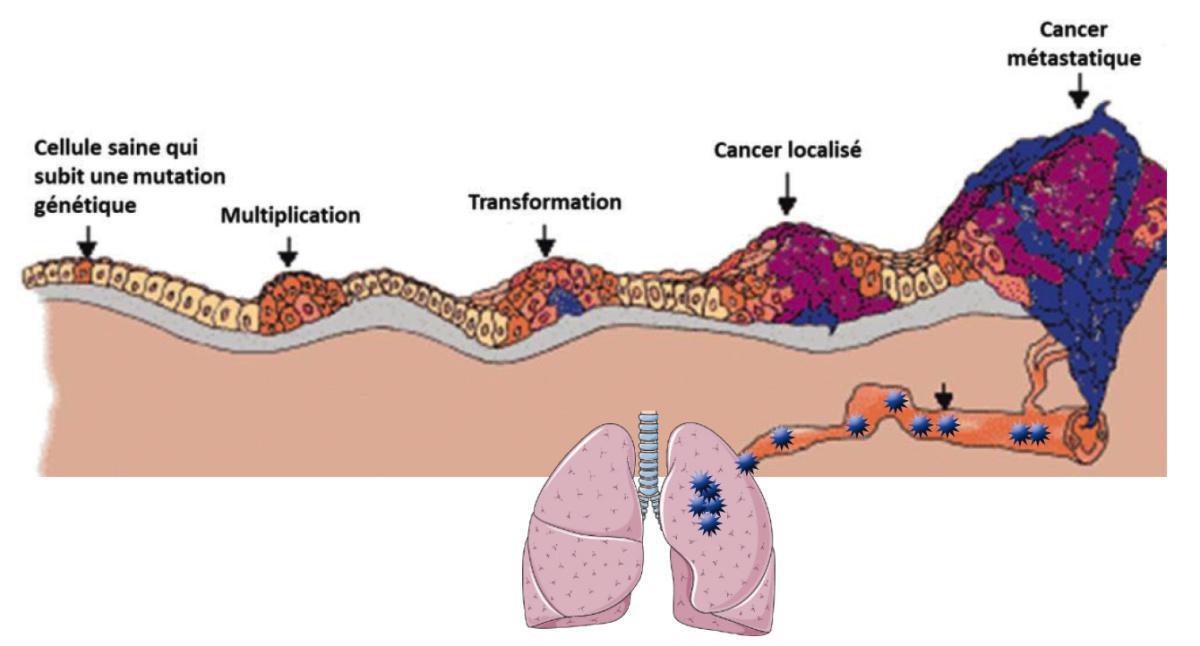 Le cancer, son développement Le cancer, son développement
