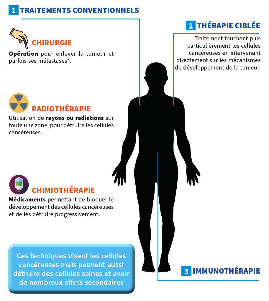 Les traitements actuels du cancer Les traitements actuels du cancer