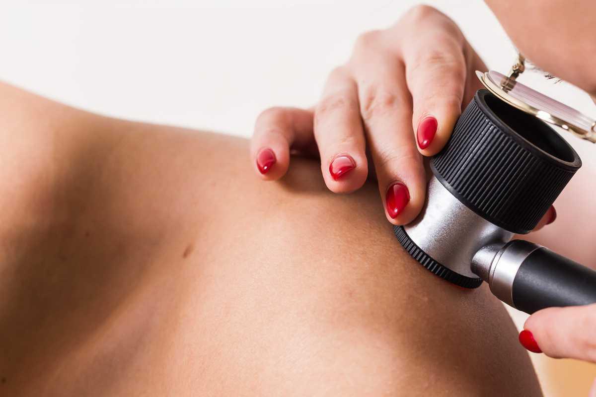 Mai est le mois de la sensibilisation au cancer de la peau ! Mai est le mois de la sensibilisation au cancer de la peau !