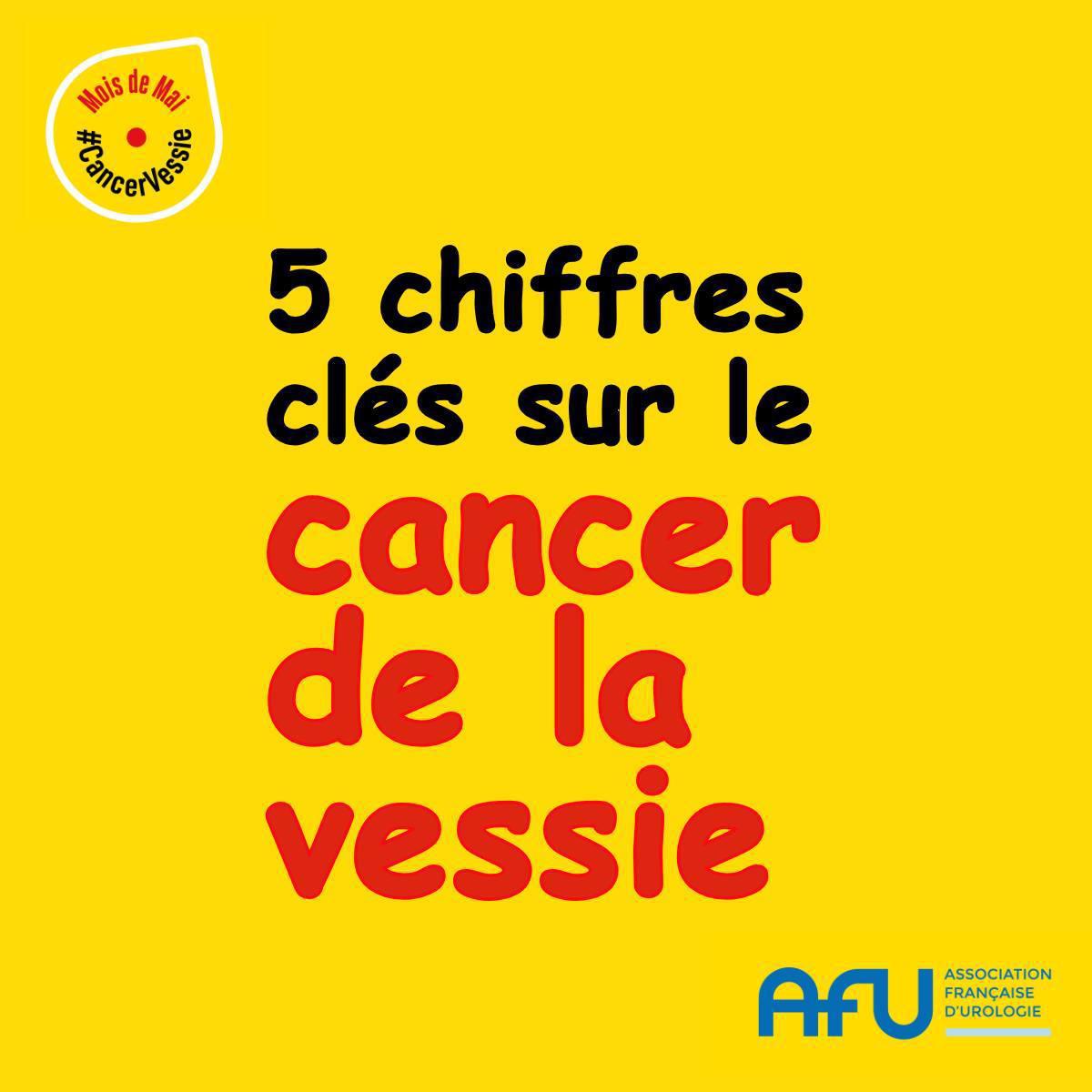 Le mois de mai, dédié à la sensibilisation au cancer de la vessie