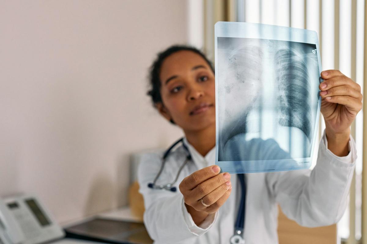 Dépistage du cancer du poumon : un programme pilote gratuit dans 5 régions