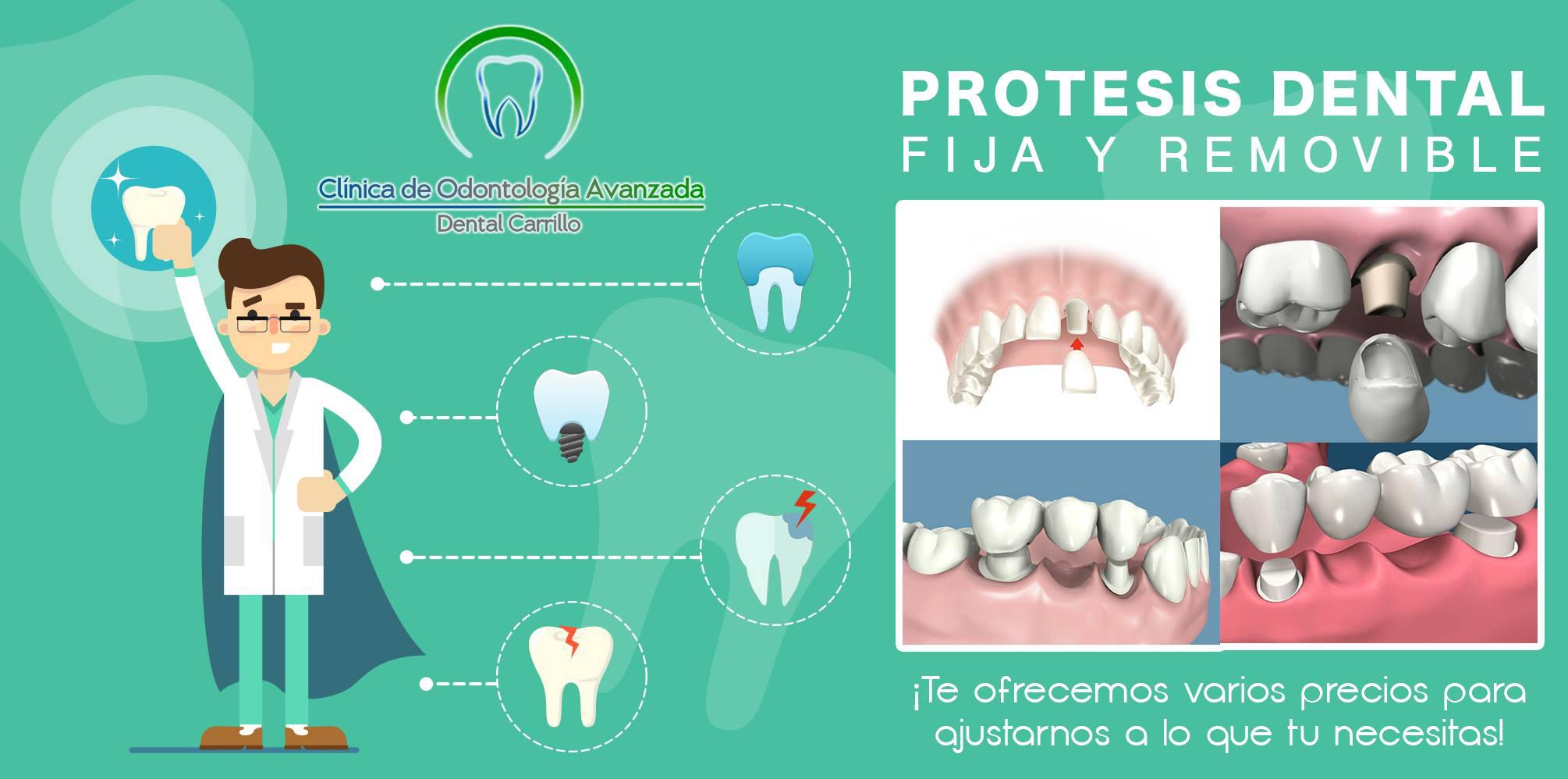 PRÓTESIS DENTAL