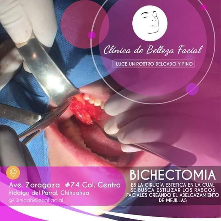 BICHECTOMIA