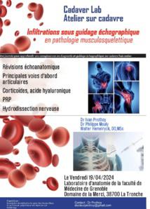 CADAVER LAB: Introduction aux infiltrations en pathologie musculosquelettique