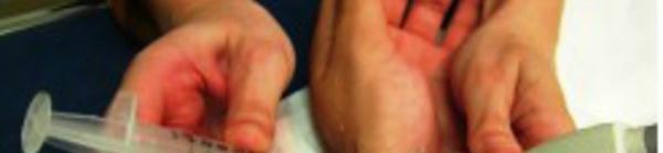 La technique du pad de gel