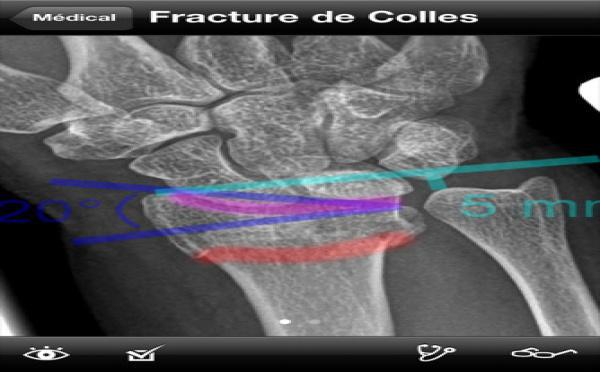 RealWorld Orthopaedics